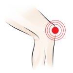 Orthotics for Knee Pain