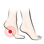 Orthotics for Tired Feet